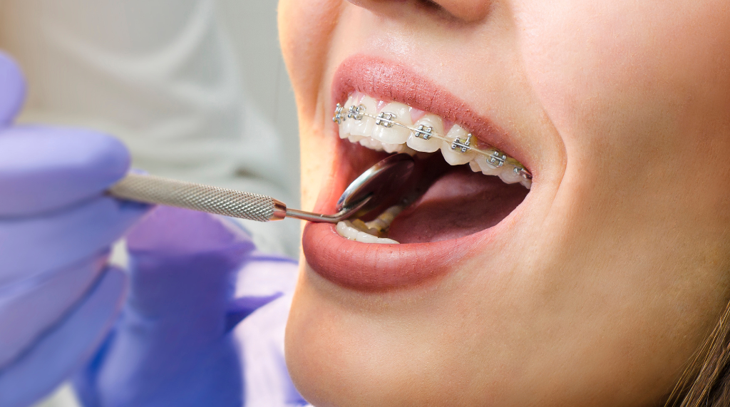 A Modern Approach to Orthodontics in Abu Dhabi