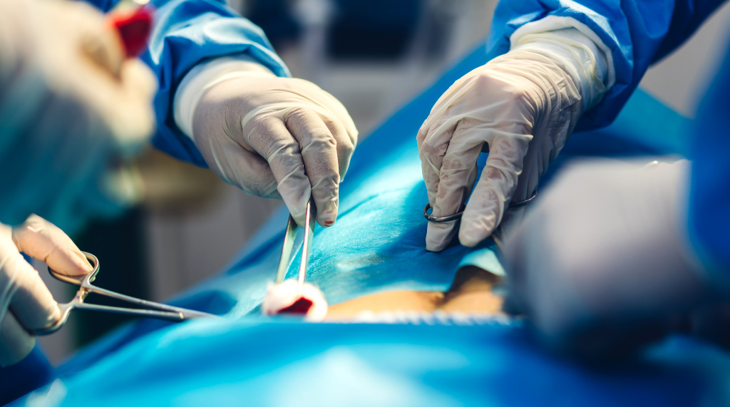 Preparing for Surgery: What Patients Should Know