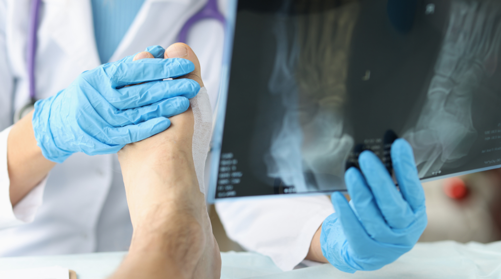 Preventing Bone and Joint Problems